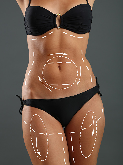Lymphdrainage image